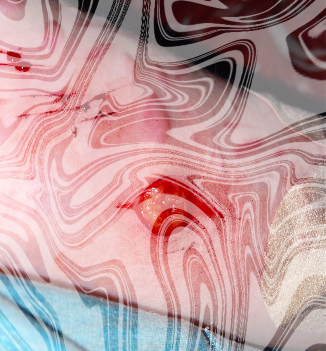 Psychobixch2's tweet photo. Fake body SFX makeup ai generated 

#sh #shedtwt #slittwt #babybeans #beanstwt #988twt #selfharm https://t.co/Jd6qbJnPiy