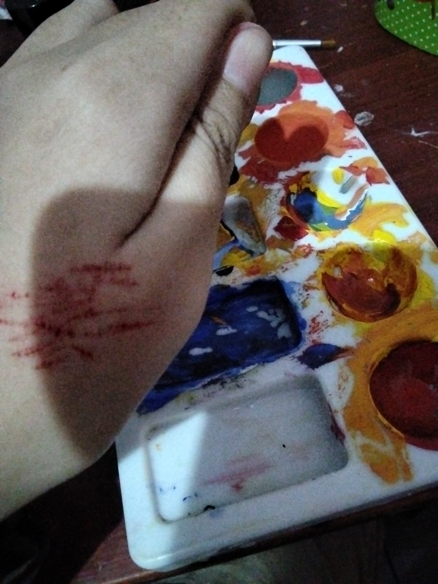 epicfoolishcow's tweet photo. (SFX MAKEUP!) (FAKE SCARS) 
THIS FUCK ASS KAI RAZOR WON'T LET ME TO GET STYRO EVEN THOUGH I MULTISWIPED IT😡😡😡😡😡😡😡😡😡😡
#shtwt #slittwt #sfxmakeup #halloweenmakeup #fakescars https://t.co/mKqcXW9wj9