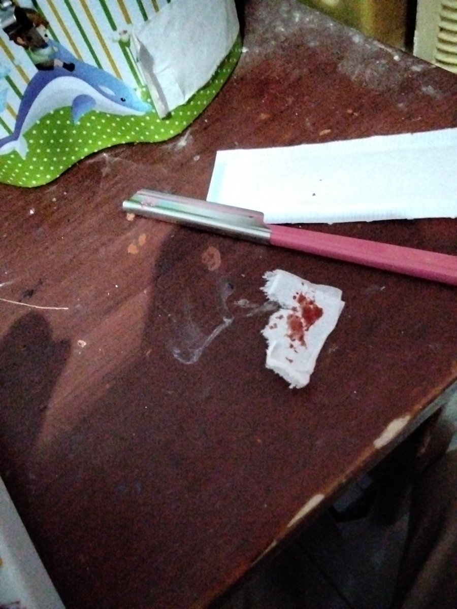 epicfoolishcow's tweet photo. (SFX MAKEUP!) (FAKE SCARS) 
THIS FUCK ASS KAI RAZOR WON'T LET ME TO GET STYRO EVEN THOUGH I MULTISWIPED IT😡😡😡😡😡😡😡😡😡😡
#shtwt #slittwt #sfxmakeup #halloweenmakeup #fakescars https://t.co/mKqcXW9wj9