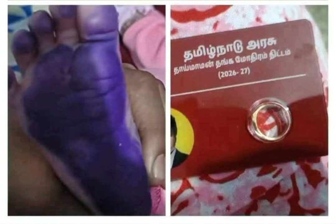 silvester2008's tweet photo. @Chandrumlpt நம்முடைய அல்டிமேட் ஜோக்கிகாரனின் மாஸ்டர்கிளாஸ் ஆட்சித் திறமை பாருங்க! அரசாங்கக் காசுல தங்க மோதிரம் கொடுக்கிறாராம், ஆனா ஒரு நலத்திட்டத்துக்காகப் பச்சைக் குழந்தை கால்ல ஊதா மை அடிச்சு கால் தடம் வாங்குற கொடுமை நடக்குது https://t.co/pnhgPFvIrb