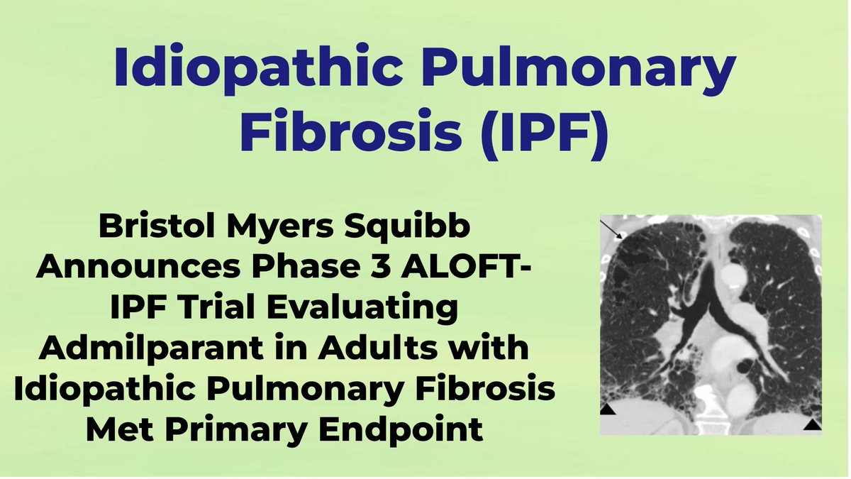CheckOrphan's tweet photo. Bristol Myers Squibb Announces Phase 3 ALOFT-IPF Trial Evaluating Admilparant in Adults with Idiopathic Pulmonary Fibrosis Met Primary Endpoint - For More Information Visit  https://t.co/ZLn8TqXs75  @bmsnews  #IPF  #Idiopathic_Pulmonary_Fibrosis  #Rare_Diseases  #Orphan_Drugs https://t.co/m7YWeGHXaq