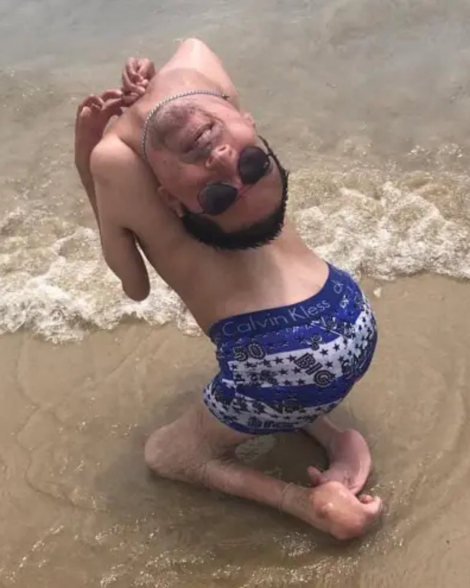 Cultination1's tweet photo. 😱🇧🇷Né avec une déformation physique extrêmement RARE, il n'était sensé VIVRE que quelques heures. Pourtant, il a défié tous les pronostics et est devenu AUTEUR et CONFÉRENCIER.

Claudio Vieira de Oliveira avait la tête est inclinée vers l’arrière, reposant sur son dos, en raison d’une maladie congénitale rare. 

Mais sa mère a refusé de le considérer comme incapable de vivre normalement. Elle l’a encouragé à devenir autonome, malgré les difficultés quotidiennes.

Claudio a appris à lire et à écrire en tenant un stylo avec sa bouche. Il utilise également ses lèvres pour manipuler son téléphone et son ordinateur. Malgré ses limitations physiques, il a poursuivi des études supérieures et obtenu un diplôme en comptabilité.

Aujourd’hui, il est devenu auteur et conférencier international. Il raconte son histoire partout et encourage les autres à dépasser leurs limites. 
(New York Post)
