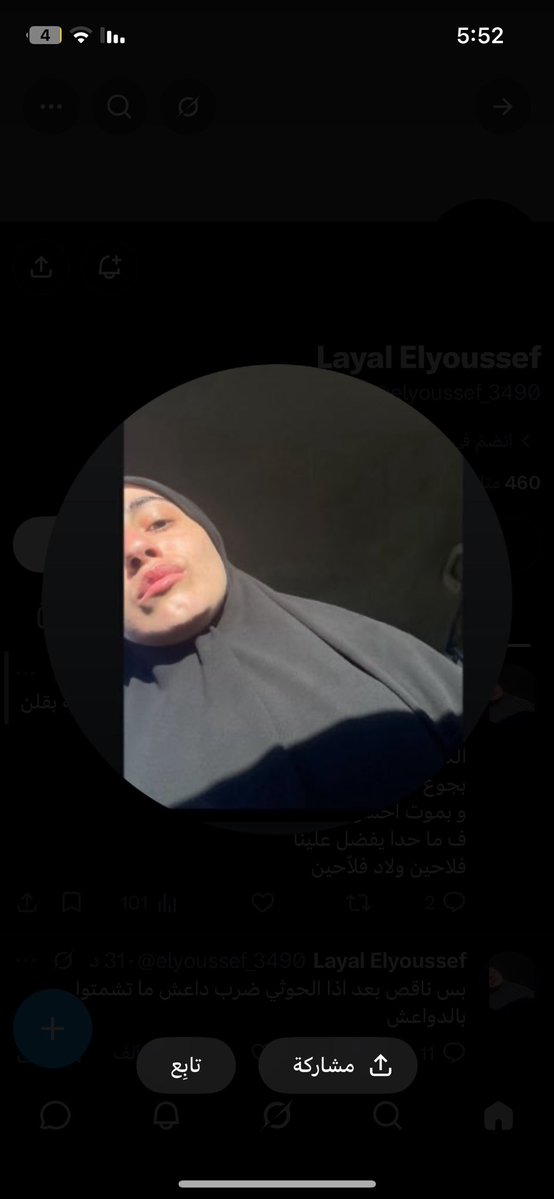 smrf_2's tweet photo. اول شي انا سعوديه بتبرع لك بمبلغ شفط لغلوغ +انتي الحمدلله انك مب مع السعوديه ولا في السعوديه ولا كان خلصتي علينا الأوكسجين من كبر مناخرك 🐽🐷 https://t.co/qiiEyuA0xc