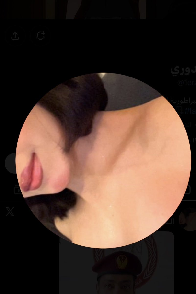 Sss3h2h's tweet photo. @1erzy اول مره اشوف انسان بدون رقبه😭😭😭 https://t.co/Z4gQ7EYpfk