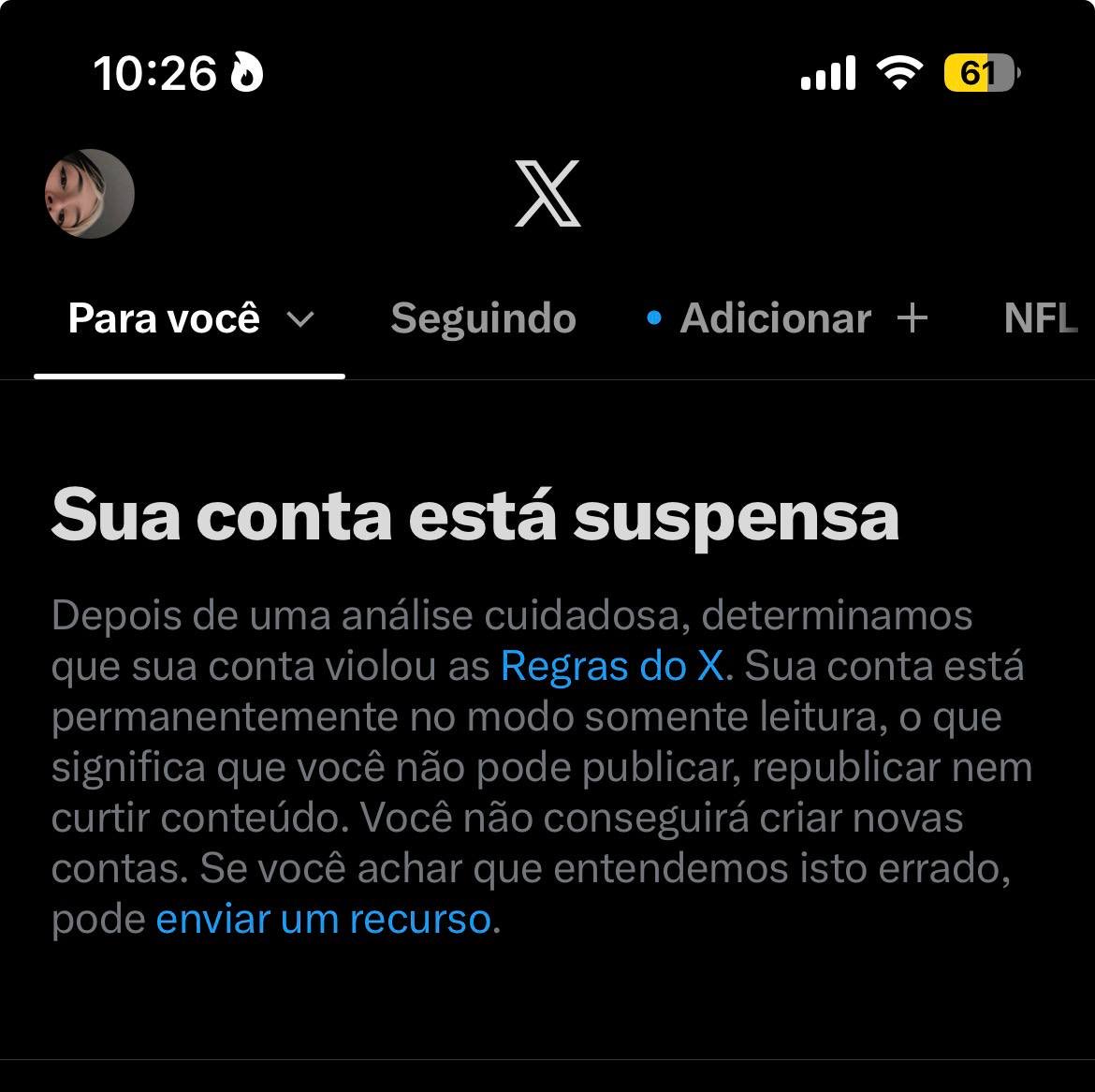 aninhakattsu's tweet photo. não pode nem mostrar a buceta em paz agora droga https://t.co/iizmls4LJR