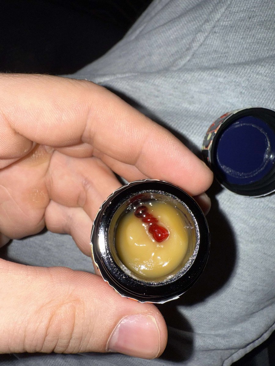 captainslabinla's tweet photo. #coketwt #drugtwt #edtwt #lines #shdtwt

https://t.co/MJ7FbqLcdo https://t.co/pHXDVDaRJf