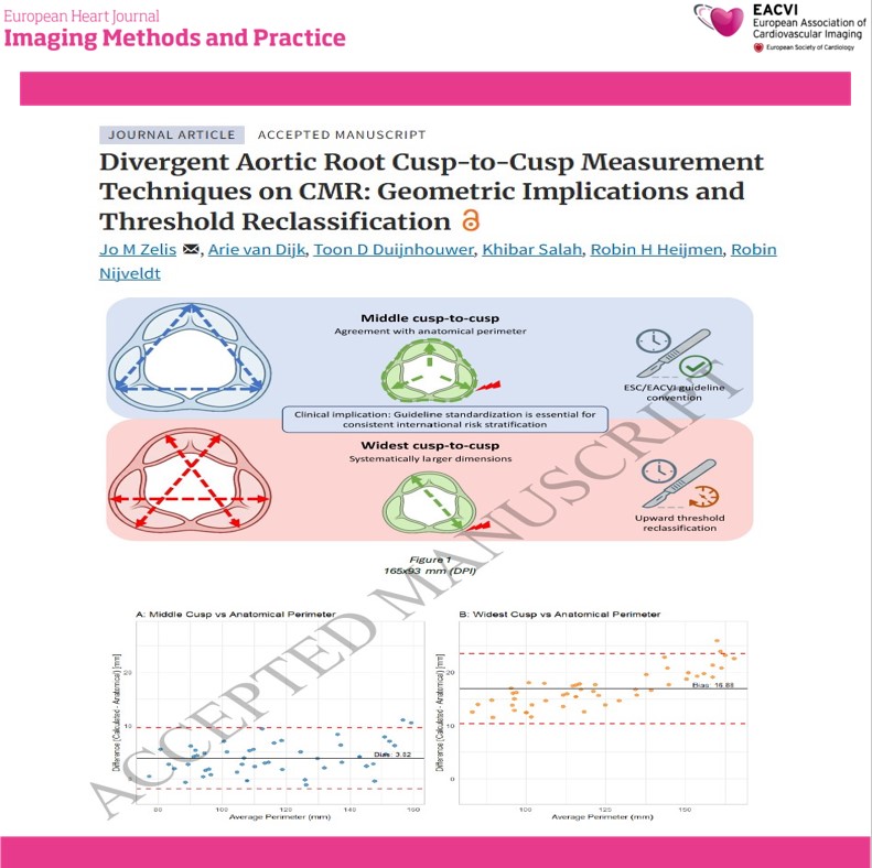 EHJIMPEiC's tweet photo. A new study in the #EHJIMP examined differences between ESC and EACTS cusp-to-cusp measurement techniques using 3D cardiovascular magnetic resonance imaging.
The study included 50 patients with a mean age of 42 years and compared:
🔹 Middle cusp-to-cusp measurements
🔹 Widest cusp-to-cusp measurements
🔹 Traced anatomical aortic root perimeter  
Key findings:
✅ Widest measurements were, on average, 3.60 mm larger than middle measurements
✅ Middle measurements showed better agreement with the traced aortic root perimeter
✅ Lin’s concordance correlation coefficient: 0.98 vs 0.80
✅ Mean absolute error: 3.96 mm vs 16.88 mm
⚠️ Use of the widest measurement reclassified 10% of patients at the 40-mm threshold and 16% at the 45-mm threshold
These findings highlight an important challenge in aortic surveillance: different guideline-recommended measurement conventions can place the same patient in different clinical risk categories.
The study emphasizes the need for:
📌 Standardized aortic root measurement techniques
📌 Improved comparability across imaging studies
📌 Consistent international risk stratification
📌 Prospective validation against clinical outcomes  
🔗 Read the full study:
https://t.co/OjoEZOHQZX
@EHJIMPEiC @VikashJaiswalMD @saramoscatelli7 @JGrapsa
#AorticDisease #AorticRoot #CardiacMRI #CMR #CardiovascularImaging #AorticAneurysm #AorticSurgery #Cardiology #CardioTwitter #CardioX #CardioED