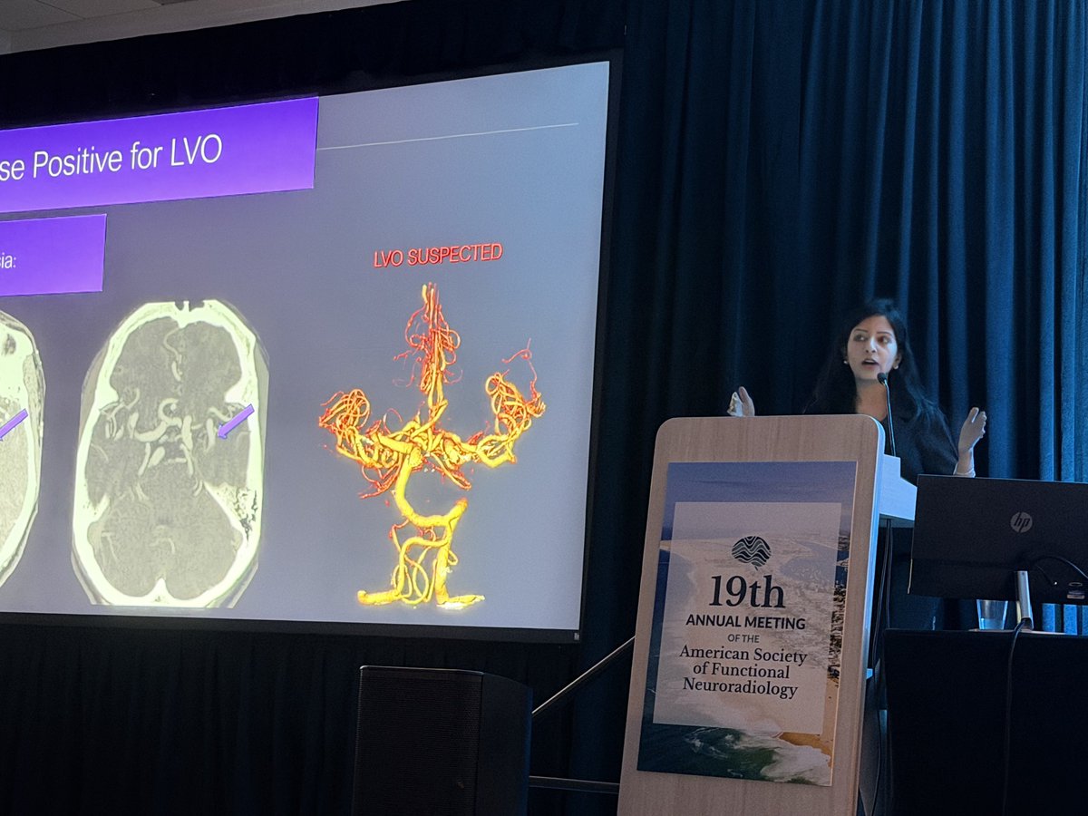 theASFNR's tweet photo. Real-world lessons on LVO and ICH detection AI tools discussed by @Aakanksha_md in this session at #ASFNR26. https://t.co/6P9r8GxX3t