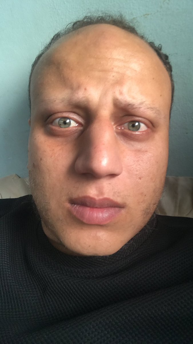 abdwaleed92's tweet photo. 3 replies — even dots — can break the algorithm 🙏🙏

We urgently need 50$ to buy food.😭🤲

 Is there anyone willing to volunteer generously to help?👇👇

GFM | https://t.co/cyDReTmZE5 https://t.co/pUga70wMIj