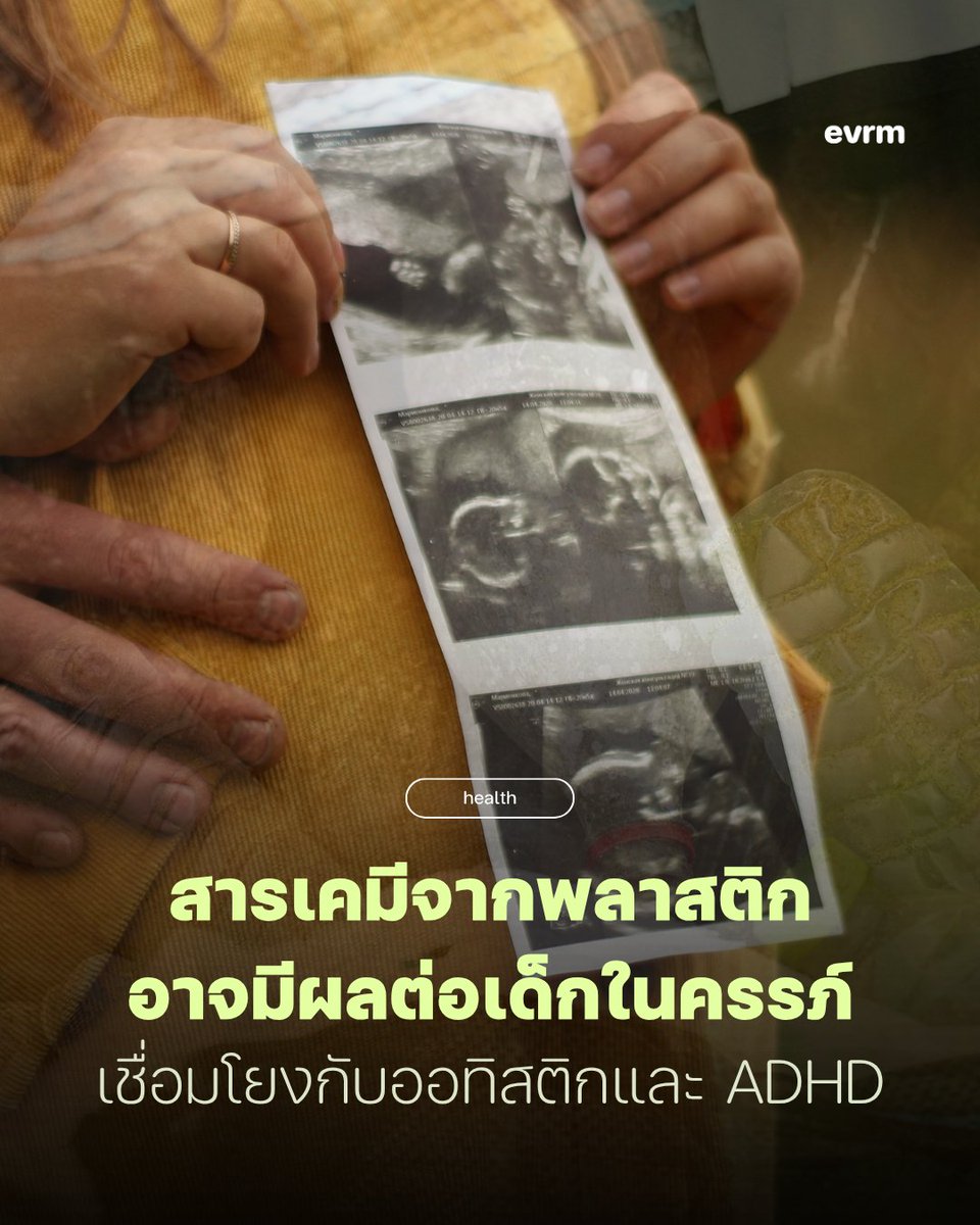 environmanth's tweet photo. ◉ HEALTH: สารเคมีในพลาสติกทั่วไป ‘อาจ’ เชื่อมโยงกับออทิสติกและ ADHD ในระหว่างตั้งครรภ์ ทั้งสองภาวะนี้เกิดจากหลายปัจจัย และงานวิจัยล่าสุดชี้ว่าเราอาจต้องพิจารณาปัจจัยใหม่เพิ่มเติม
.
ปัจจุบันเกิดขึ้นชวนงงให้กับนักวิทยาศาสตร์ว่า ทำไมถึงมีคนได้รับการวินิจฉัยว่าเป็นภาวะออทิสติกและ ADHD สูงขึ้น ทำไมเด็กจำนวนมากทั่วโลกถึงประสบกับปัญหาด้านพฤติกรรมมากขึ้น และสารเคมีในพลาสติกส่งผลกระทบยังไงต่อสมองของเรารึเปล่า? นี่เป็นคำถามที่กำลังได้รับการศึกษามากขึ้นเรื่อย ๆ
.
งานวิจัยใหม่นี้ได้เผยแพร่บนวารสาร Med ซึ่งได้ศึกษาลักษณะพฤติกรรมของเด็กในช่วงอายุ 2 และ 4 ปี ระบุว่า เด็กที่ได้รับสาร DEHP ตั้งแต่ช่วงที่อยู่ในครรภ์ อาจมีความเชื่อมโยงกับภาวะออทิสติกและ ADHD แต่ยังมีข้อจำกัดของการศึกษาที่ควรได้รับการใส่ใจต่อไป
.
“สิ่งที่เราค้นพบคือคำอธิบายทางชีวภาพที่เป็นไปได้ และเป็นหลักฐานใหม่ที่ชี้ว่าการได้รับสาร DEHP ในระหว่างการตั้งครรภ์ อาจมีส่วนที่ทำให้เกิดภาวะออทิสติกและ ADHD ได้” Sam Tanner หัวหน้าคณะผู้วิจัยกล่าว
.
DEHP คืออะไร? DEHP ย่อมาจาก di-(2-ethylhexyl) phthalate มันเป็นสารเคมีสังเคราะห์ที่ช่วยเพิ่มความยืดหยุ่นให้กับพลาสติก มักพบในวัสดุหุ้มเฟอร์นิเจอร์ไวนิล สายยางรดน้ำต้นไม้ ม่านห้องน้ำ ท่อทางการแพทย์ และหนังเทียม (Vegan leather)
.
สิ่งที่น่าห่วงก็คือ สารเหล่านี้สามารถหลุดออกมาจากวัสดุที่ผสมอยู่ได้ง่าย ทำให้มันปนเปื้อนเข้าไปในอาหาร น้ำดื่ม และท้ายที่สุดก็เข้าไปในร่างกายของเรา ก่อนหน้านี้การศึกษาในสัตว์ทดลองและการศึกษาเชิงสังเกตในมนุษย์ พบความสัมพันธ์ทางสถิติ (ที่ไม่ใช่ความเป็นเหตุเป็นผลโดยตรง) ว่าสารนี้เชื่อมโยงกับภาวะดังกล่าว
.
งานวิจัยใหม่ได้เจาะลึกความสัมพันธ์นี้มากขึ้น โดยเฉพาะอย่างยิ่งปัจจัยทางเอพิเจเนติกส์ (epigenetics) ที่มักศึกษาว่าปัจจัยด้านสิ่งแวดล้อมส่งผลต่อการทำงานของยีนยังไงบ้าง โดยที่ลำดับของดีเอ็นเอ (DNA sequences) ไม่ได้เปลี่ยนไป
.
เข้าสู่วิธีการศึกษา
ทีมวิจัยได้เก็บข้อมูลตั้งแต่ก่อนที่ทารกจะคลอดสู่โลก โดยจะเก็บตัวอย่างปัสสาวะของมารดาแต่ละคน 1 ครั้งเมื่อตั้งครรภ์ได้ 36 สัปดาห์ เพื่อตรวจหาสาร สารเมตาโบไลต์ (metabolites) ซึ่งช่วยให้สามารถประเมินปริมาณ DEHP ที่มารดาได้รับเข้าสู่ร่างกายในแต่ละวันได้ (เป็นผลผลิตพลอยได้ที่ร่างกายสร้างขึ้นเมื่อมีการย่อยสลายสารพทาเลต (phthalate) ชนิดนี้)
.
จากนั้นเมื่อทารกคลอดออกมา นักวิจัยได้สกัด DNA จากเลือดสายสะดือเพื่อวิเคราะห์หาลักษณะทางเอพิเจเนติกส์ที่อาจมีความเชื่อมโยงกับการได้รับสาร DEHP ผลลัพธ์ระบุว่ากลุ่มยีนจำนวน 531 ยีน ได้รับผลกระทบ และการสำรวจอีกครั้งที่ครอบคลุมตำแหน่งต่าง ๆ บนจีโนม 1,000 จุดก็ให้ผลไปในทิศทางเดียวกัน
.
“เด็กที่มี ‘ร่องรอยทางเอพิเจเนติกส์’ นี้ แสดงอาการที่เกี่ยวข้องกับออทิสติกและ ADHD มากกว่าเมื่ออายุ 2 และ 4 ขวบ โดยผลกระทบนั้นชัดเจนกว่าในเด็กผู้ชายเมื่อเทียบกับเด็กผู้หญิง” Tanner กล่าว
.
ข้อจำกัดที่ต้องพิจารณา
ประการแรก การเก็บตัวอย่างปัสสาวะเพียงครั้งเดียว ไม่ได้สะท้อนถึงระดับสารในร่างกายตามปกติของบุคคลนั้น ๆ ในระยะยาวเสมอไป และไม่ได้มาจากการวัดค่าโดยตรงเช่น ระดับ DEHP จากตัวทารก รก หรือมดลูกจริง ๆ
.
ต่อมา การศึกษานี้เป็นการศึกษาเชิงสังเกต (Observational study) ไม่ใช่การทดลอง (Experimental study) จึงไม่สามารถสรุปเป็นความสัมพันธ์เชิงสาเหตุและผลลัพธ์ได้ แต่มันก็ชี้ให้เห็นถึงประเด็นที่สำคัญว่าพลาสติกอาจสร้างผลกระทบต่อร่างกายของเรามากขึ้นเรื่อย ๆ
.
“สารเคมีในพลาสติกอย่าง DEHP มักเข้าสู่ร่างกายผ่านการรับประทานอาหาร ดังนั้น กฎระเบียบด้านความปลอดภัยของภาครัฐที่เกี่ยวข้องกับกระบวนการผลิตอย่างบรรจุภัณฑ์อาหาร จึงมีความสำคัญอย่างยิ่ง” ศาสตราจารย์ Anne-Louise Ponsonby หัวหน้ากลุ่มวิจัยระบาดวิทยาทางประสาทวิทยา (Neuroepidemiology Research Group) ของสถาบัน The Florey กล่าว
.
พร้อมเสริมว่า ผลการศึกษานี้เรียกร้องให้มีการทบทวนเกณฑ์ความปลอดภัยสำหรับการได้รับสาร DEHP และสารเคมีในพลาสติกชนิดอื่น ๆ ในระหว่างตั้งครรภ์
.
ที่มา

https://t.co/SYHQOcEYC3