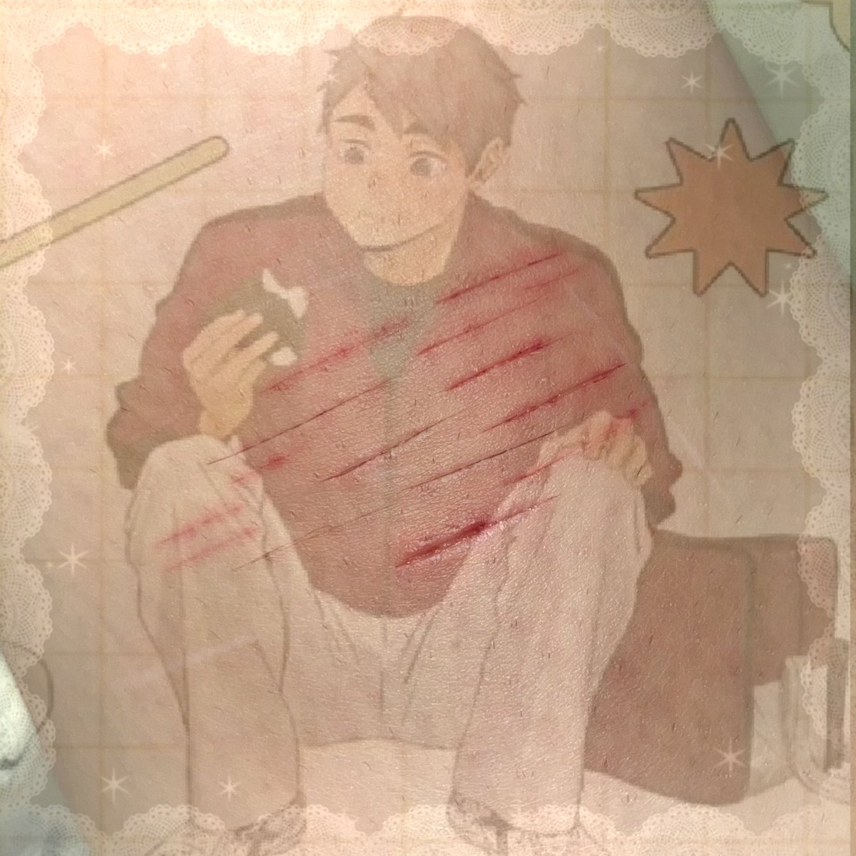 crabmeatkani's tweet photo. Ew ew I hate how half healed scars look 

!!this is fake, ai generated! Not real!!

#sharm #sh #sharmtwt #shtwt #cuttwt #slittwt #osamumiya https://t.co/f9jdoZCstJ