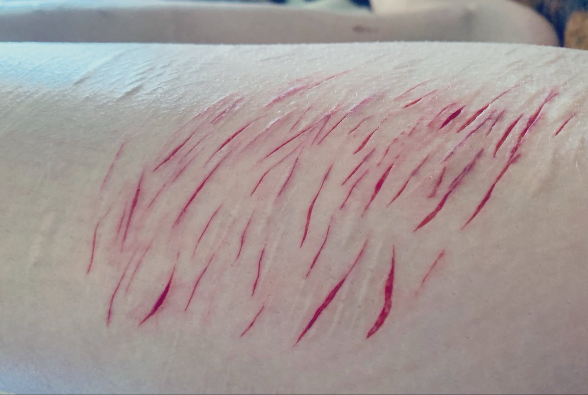 Viktamiu's tweet photo. Makeup Halloween, blood fake!
fresh wounds (ᐢ⑅ᐢ) 
#Slittwtr #shtwtr #988twt #selfharm https://t.co/2VeespWOZY
