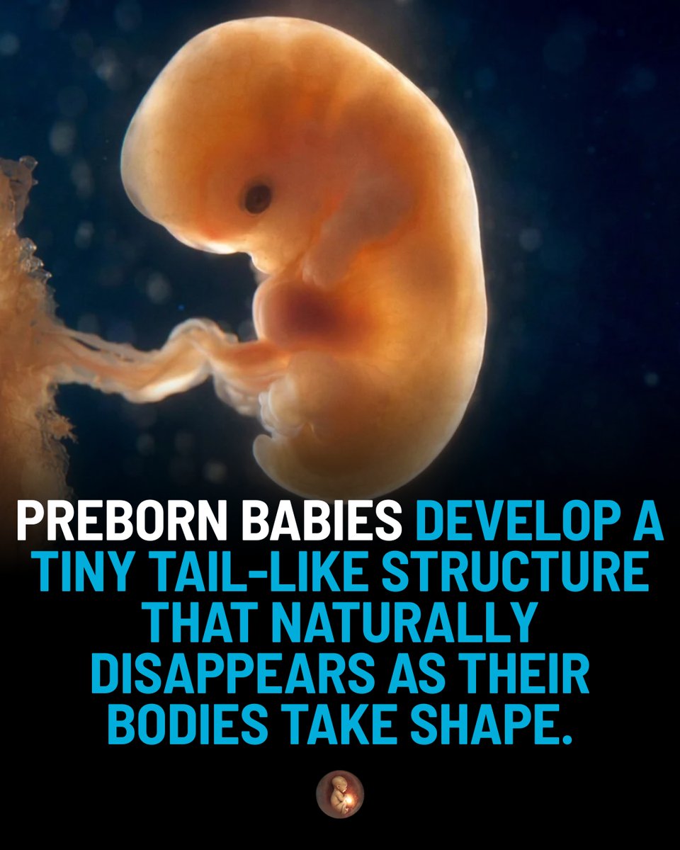 BabyLifeBegins's tweet photo. Some prenatal development facts sound too strange to be true! 👀🤯

Swipe through Part 3 to discover the surprising science of life before birth! 💙

✨ Which fact surprised you most?

#BabyLifeBegins #PrenatalDevelopment #Embryology https://t.co/ecANsAoege