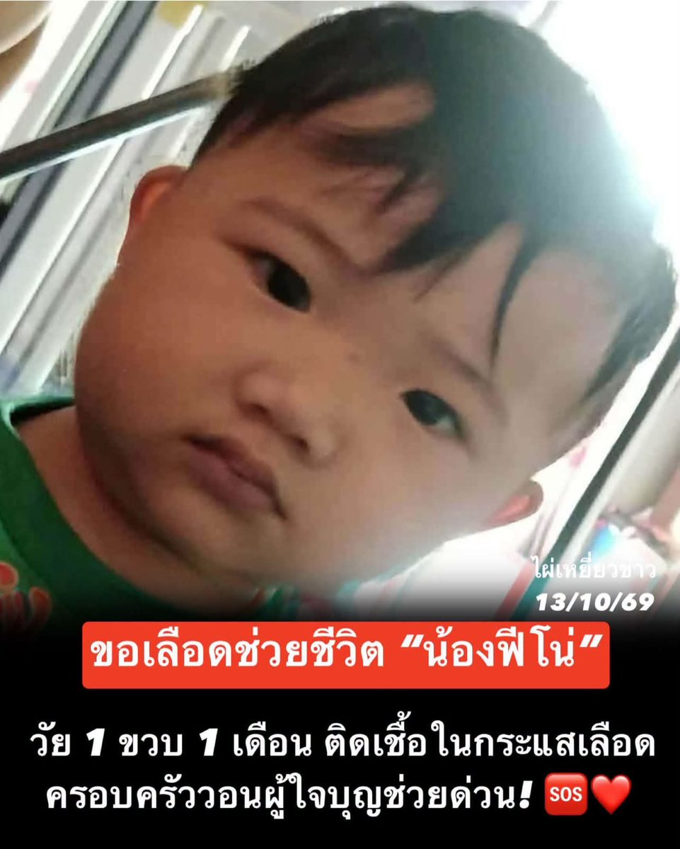 LoveyouApo's tweet photo. ตอนนี้ครอบครัวกำลังรอความช่วยเหลือจากทุกน้ำใจ 🙏🏻

น้องจิรพัฒน์ เทียนชุบ หรือ “น้องฟีโน่” อายุเพียง 1 ปี 1 เดือน กำลังรักษาตัวอยู่ที่โรงพยาบาลพระพุทธชินราช จ.พิษณุโลก หลังติดเชื้อในกระแสเลือด

📌 ครอบครัวขอความเมตตาจากผู้ใจบุญที่สะดวกบริจาคเลือด เพื่อช่วยเหลือน้องในช่วงเวลาสำคัญนี้

🩸 รับบริจาคเลือดทุกกรุ๊ป

🏥 สถานที่: โรงพยาบาลพระพุทธชินราช จ.พิษณุโลก

📞 ติดต่อสอบถาม: แม่ของน้องฟีโน่ (เบอร์โทรศัพท์อยู่ในคอมเมนต์)

 ใครที่สะดวกบริจาค ขอความกรุณาติดต่อสอบถามรายละเอียดก่อนเดินทาง ส่วนใครที่ไม่สะดวกบริจาคเลือด ช่วยแชร์โพสต์นี้ออกไปให้ถึงคนที่ช่วยน้องได้ เพราะการส่งต่อเพียงครั้งเดียว อาจทำให้ความช่วยเหลือไปถึงน้องได้เร็วขึ้น 
: 064-653-6321 (เบอร์แม่น้อง)

: 064-653-6321 (เบอร์แม่น้อง)

🙏🙏🙏🙏🙏🙏🙏

#ไผ่เหยี่ยวข่าว
#ช่วยน้องฟีโน่ #บริจาคเลือด #พิษณุโลก

https://t.co/TwPczZqcdJ