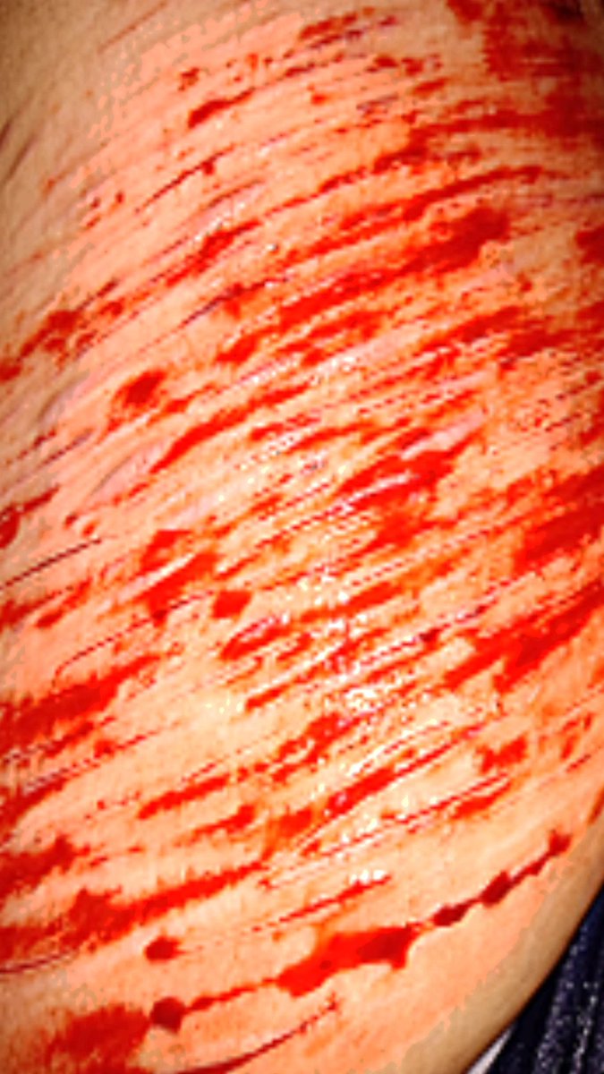 _DumbD0G's tweet photo. Washing away my REALISTIC SFX MAKEUP ENHANCED BY AI IT'S AI GENERATED NOT REAL FAKE FAKE FAKE does this do anything. At all. Am I doing this right. I crunched the quality to take precautions https://t.co/gpcK7M0jx7