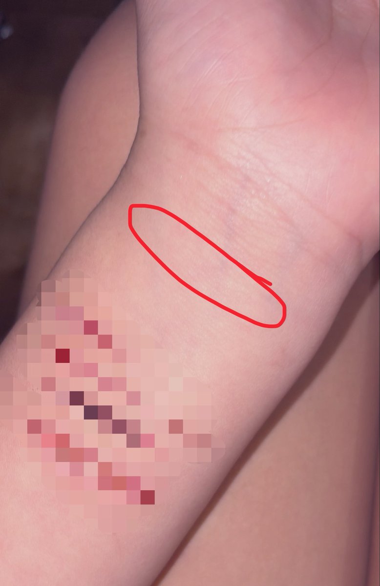 stuckkinaditch's tweet photo. how safe is it do a deep styro here??
#shtwtt #shrtwtt #ouchietwt #cuts
not encouraging self harm! https://t.co/Jc1m3lhWcq