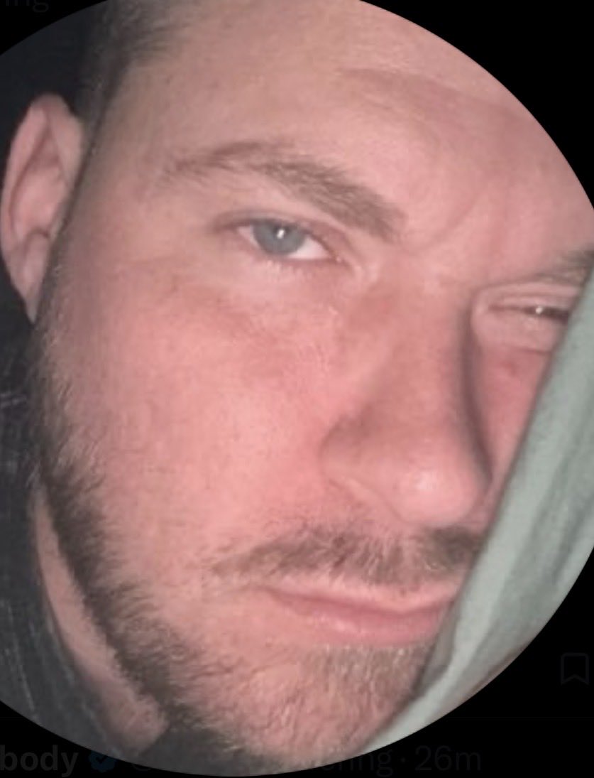 MWadejk87's tweet photo. @ServeTsuffering @itsearthi Look at all the deep set wrinkles are already forming in your pink melaninless  skin… 

Textbook, recessive genes https://t.co/m1wWjDCT78