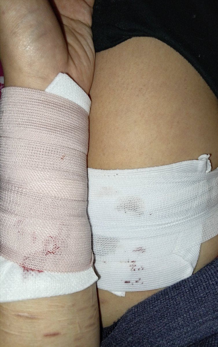 bluberroui's tweet photo. wait call me aftercare queen 

(sfx!!! fake blood, halloween costume) 

#slittwt #988twt #ouchie https://t.co/As5YGnnpBU
