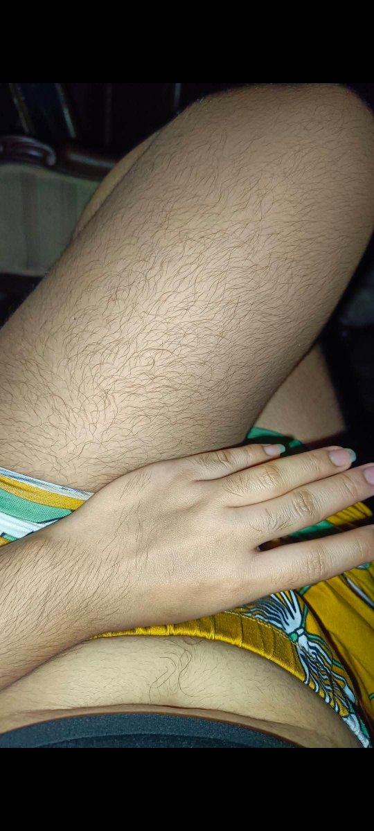 cokeibs7's tweet photo. Hairy https://t.co/RN9IefF59F