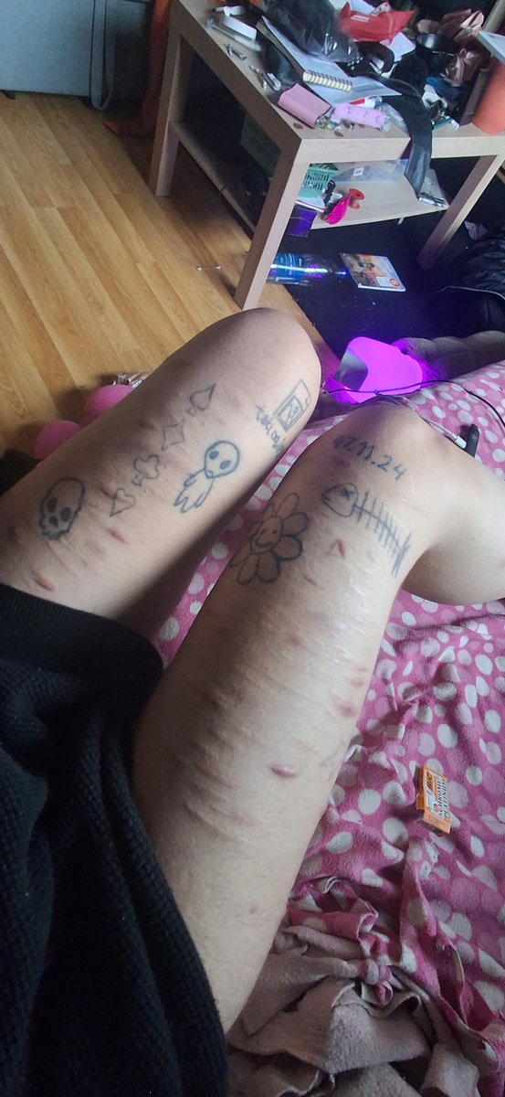 decayedwhole's tweet photo. so, so, SO FAT. oh my god im actually so fucking disgusted, i feel iy physically. ive never felt anger and DISGUST as extreme as i am right now.  #edrtwt #anatwt #shedtwt #shtwt #988twt #ricecaketwt #scarspo https://t.co/IaobSQwWhy