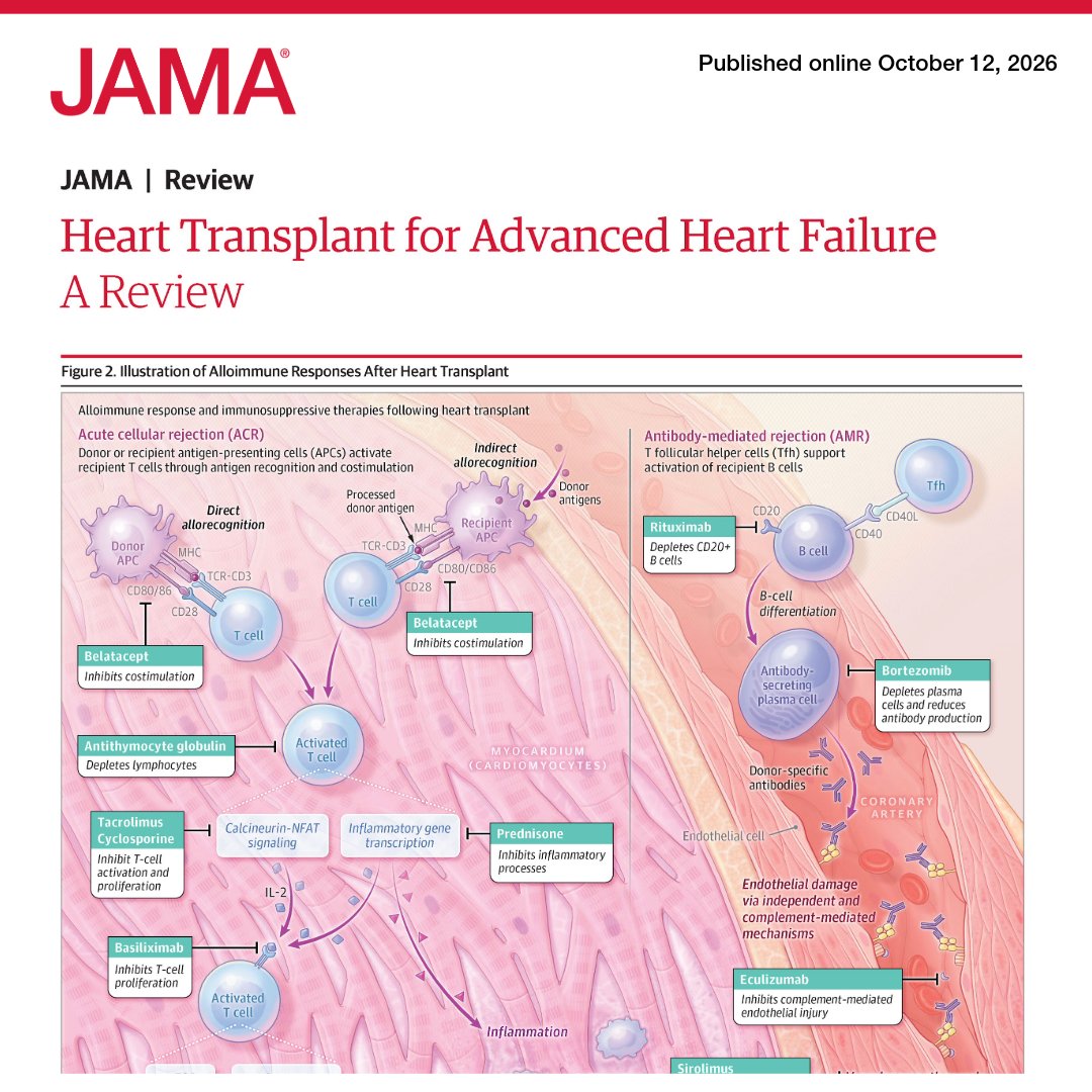 JAMA_current's tweet photo. #JAMAReview: Among adults undergoing #HeartTransplant, contemporary survival is high, but long-term outcomes depend on surveillance for rejection and #cardiac allograft #vasculopathy and careful management of #immunosuppression-related complications. 

This Review summarizes early referral using the “I NEED HELP” criteria, transplant candidacy, and the need for lifelong multidisciplinary care after transplant to manage immunosuppression, rejection, infection, malignancy, and cardiac allograft vasculopathy.

https://t.co/F9o5ff4JYP