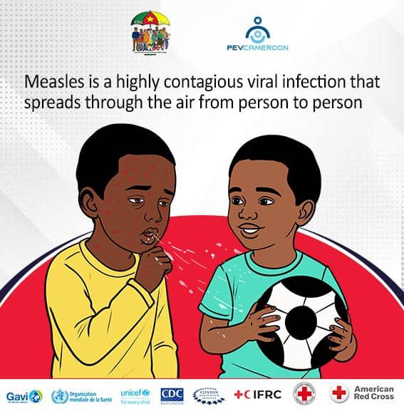 CTeussop's tweet photo. 🚨 La #rougeole est une infection virale très contagieuse (transmission par la toux/éternuements) !
🗓️ Campagne de #vaccination : 14 – 18 oct. 2026
Protégeons nos enfants ! / Let’s protect our #children! ❤️
🔁 Retweetez pour partager l'info & sauver des vies. #stopRR237 https://t.co/nu038IrLKT