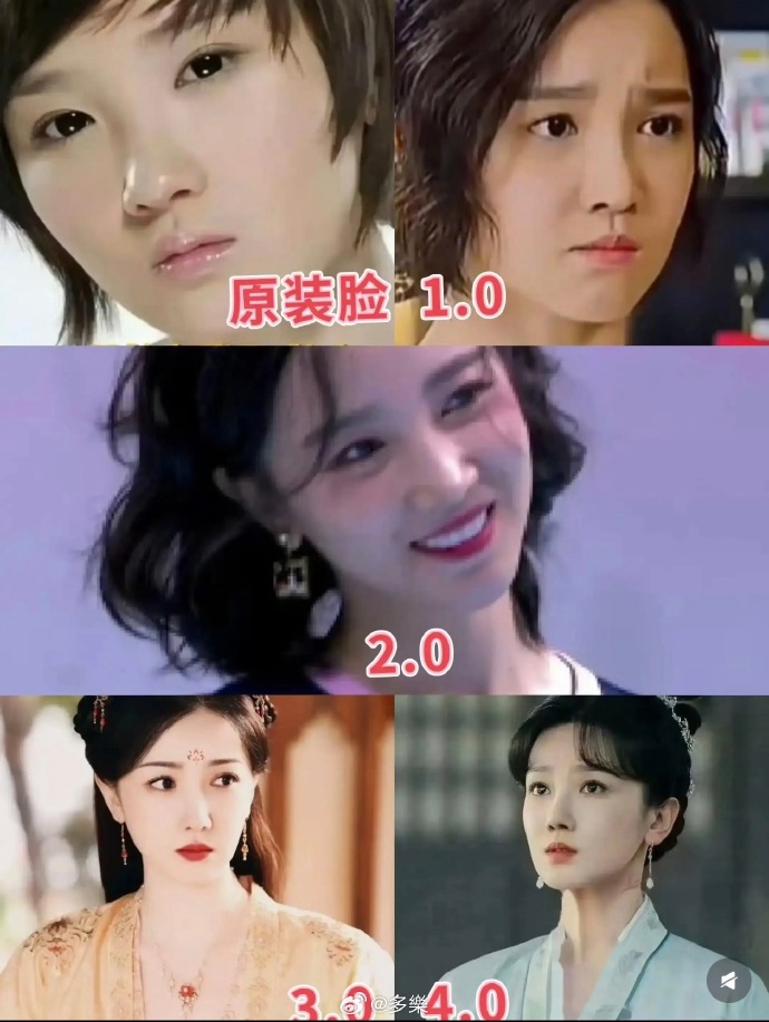oolongdispatch's tweet photo. 🫖 #ChenXiaoyun’s latest appearance at Shanghai Fashion Week has cnetz saying she looks almost unrecognisable... and her past cosmetic procedures are back in the spotlight.

You might remember her as Hao Jia in New Life Begins, Suoxin in Ruyi’s Royal Love in the Palace or Tilan in Novoland: Pearl Eclipse. Chen previously spoke about undergoing nearly 10 facial contouring treatments to make her face slimmer and just how painful the process was.

But there's something quite sad about all this. East Asian beauty standards can be incredibly unforgiving towards women, especially in an entertainment industry where having the 'right' face can make a real difference to your opportunities. Women who don't naturally fit that ideal can feel pressured to change themselves just to get a foot in the door.

And then when their appearance changes, the same public that rewards those beauty standards criticises them for no longer looking natural. It's hard not to feel a little sympathy for women caught in that cycle... where you're expected to look perfect, but also like you were born that way.