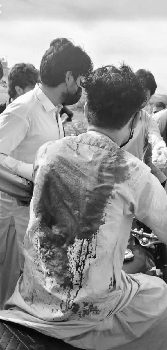 rahatafri87's tweet photo. باڑہ میں پی ٹی آئی کے نہتے کارکنان پر جو بلکل پر امن ہے اس پر پاکستانی استعمار کے نوکرونو نے ان گولیوں پر اپنے ہی لوگوں کو مارنا شروع کیا جو ہمارے ٹیکسوں پر دشمن کیلئے خریدے گئیں ہیں!!
ایک کارکن شدید زخمی!
لعنت بھیجتا ہو !!
@MashwaniAzhar @rizwanghilzai @OfficialShehr @SHABAZGIL https://t.co/sykw2FFUM2