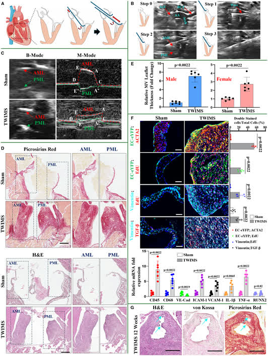 JAHA_AHA's tweet photo. A minimally invasive murine model capturing both structural remodeling and functional stenosis seen in human mitral stenosis. #ResearchLetter https://t.co/RoZKu1hZZ3 https://t.co/jhLwOuXy6R