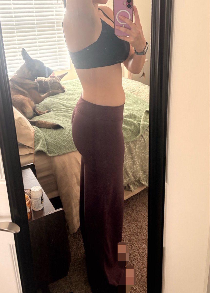 tinybvnnii's tweet photo. Current bc’s, (blurred out my tats) hopefully in a couple months I’ll be able to post a progress pic and there’ll be a huge difference. :’) for now these will be my inspiration since they’re hard for me to even look at. https://t.co/n5sXLCsZc4