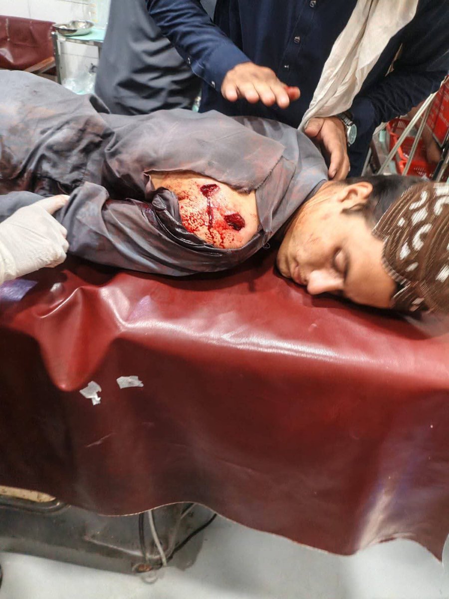 TheRealThoka_'s tweet photo. Asim Munir and Moshin Naqvi both are butcher's of Pakitan and responsible for this brutality. The injured have been transferred to Peshawar Hospital.
#اب_بدلے_گا_خیبرپختونخواہ
#پختونخواہ_میں_احتساب_کرو
#آئین_شکن_راج_نہیں_چلے_گا
#قوم_کی_امید_عاصم_منیر
#پاک_فوج_ہماری_شان https://t.co/G8UCEHj29G