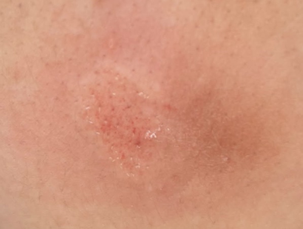 sprinkelcakes's tweet photo. I’m so fucking annoyed this skinny ginger twat pushed me down into a bush and ruined my 80 pound bag (victorias secret bag, brand new ☹️☹️) and got me bruised on my back and elbow. https://t.co/S8dxKE2WlA
