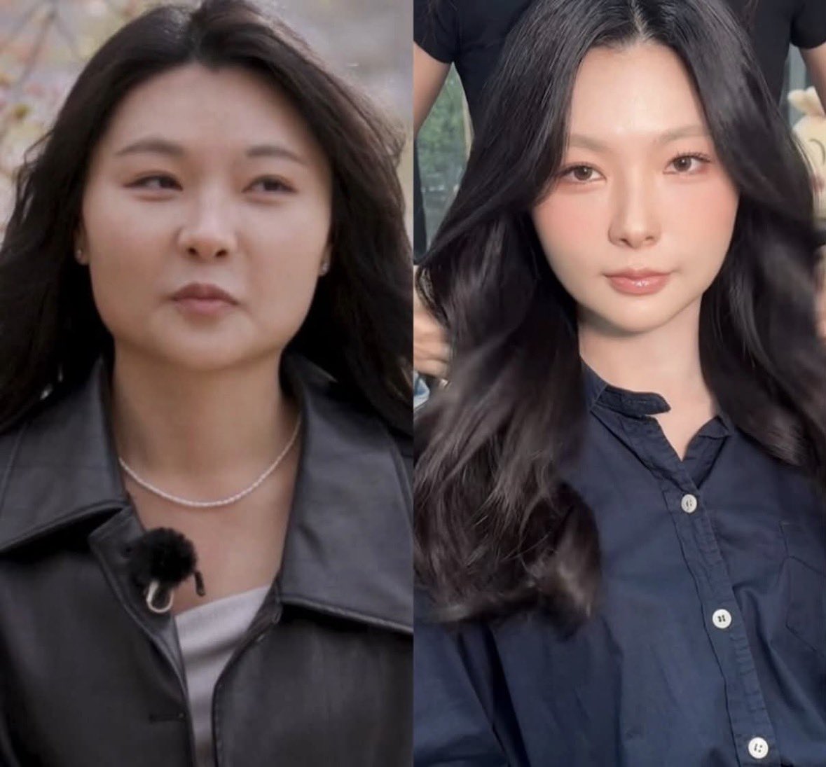 sonsudiggng's tweet photo. 와 나솔 33기 정숙 비포애프터 쩐다ㄷㄷ

방송볼 때 이분 이목구비 진짜 예뻐서
시술 좀만 하면 장난 아니겟다 싶엇는데 역시

울쎄라+세르프+힐로웨이브+힐로웨이브 ID
조졋다구함 

힐로웨이브 ㅈㅉ 좋다던데..
근데 이거 다 하면 돈이 장난 아니게 많이 들듯ㅜㅜ
돈벌어야지 https://t.co/pRA3AtRdIP