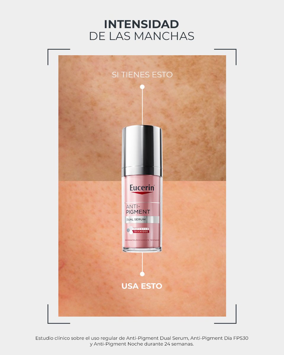 EucerinES's tweet photo. ¿Qué tipo de manchas trata #AntiPigment Dual Serum?

Formulado con #Thiamidol, reduce todo tipo de manchas, visibles y no visibles. Trata la #pielconmanchas producidas por la edad o cambios hormonales, también conocidas como #manchassolares o #melasma

👉 https://t.co/Dutogm6svR https://t.co/vDi2zfX5aS