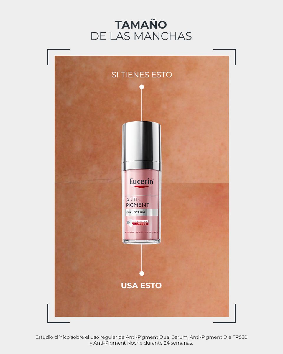 EucerinES's tweet photo. ¿Qué tipo de manchas trata #AntiPigment Dual Serum?

Formulado con #Thiamidol, reduce todo tipo de manchas, visibles y no visibles. Trata la #pielconmanchas producidas por la edad o cambios hormonales, también conocidas como #manchassolares o #melasma

👉 https://t.co/Dutogm6svR https://t.co/vDi2zfX5aS