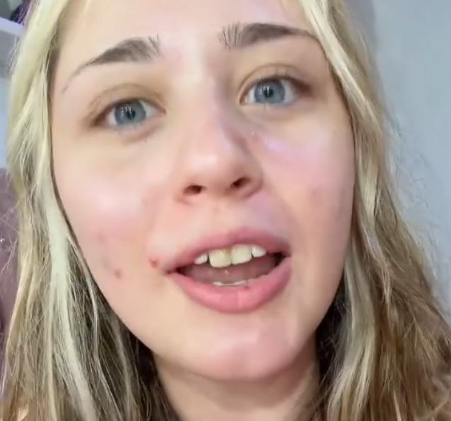 DalasReview's tweet photo. De eso nada amiga. Tiene los dientes podridos de sarro y se nota que en la vida ha pisado un dentista.

Y esto no es físico, es higiene. La tipa tiene los dientes del mismo color del pelo. Ya déjate de joder y de defender a esta payasa que encima empezó ella atacándome de la nada, ridícula.