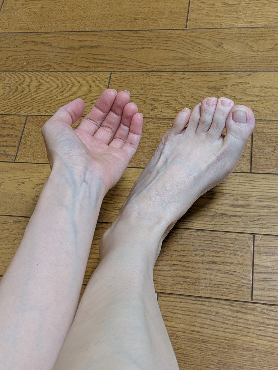 guchirasetene_'s tweet photo. おはよう血管
ハンドクリーム必須になってきた
カサカサ‥ https://t.co/ZhSfbZMP1s