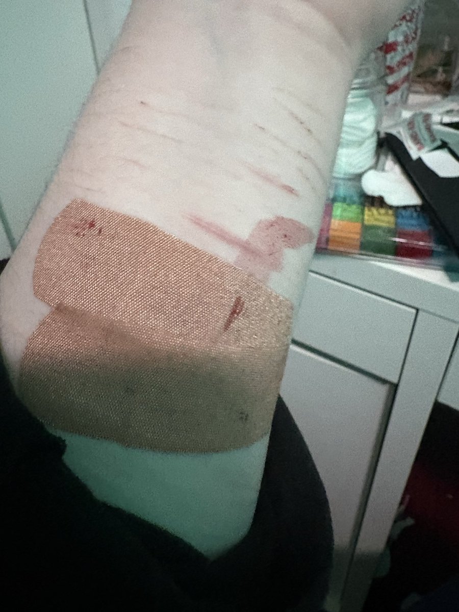 bl00dyorigin's tweet photo. It’s bleeding thru the bandaid ugh SFX MAKEUP ALL FAKE ALL FAKE https://t.co/qIbeyMYOAc