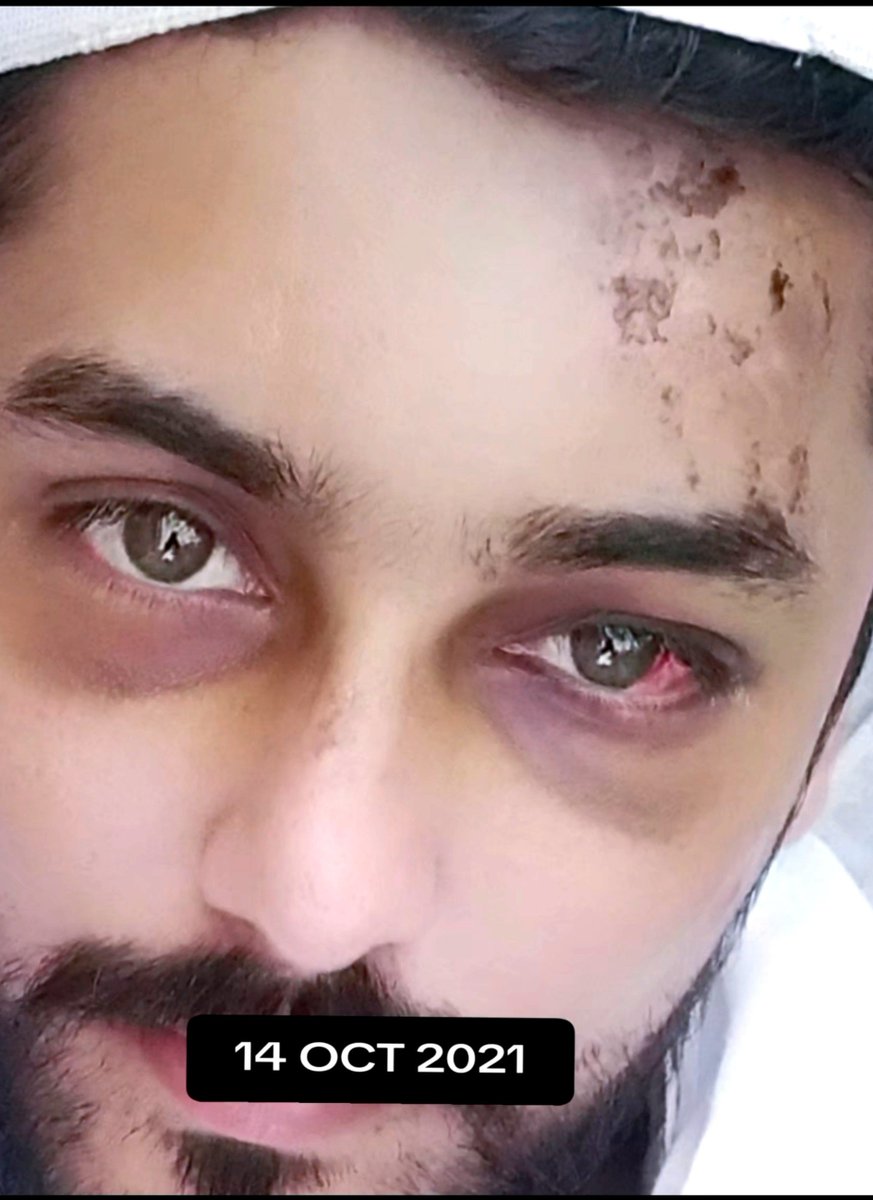 ijazkhan1996's tweet photo. The day I survived that bad road accident, and Allah gave me a second chance; a day I’ll never forget and since than every breath is for granted.
Happy 5th re-birthday to me. https://t.co/PQKpgaffIn