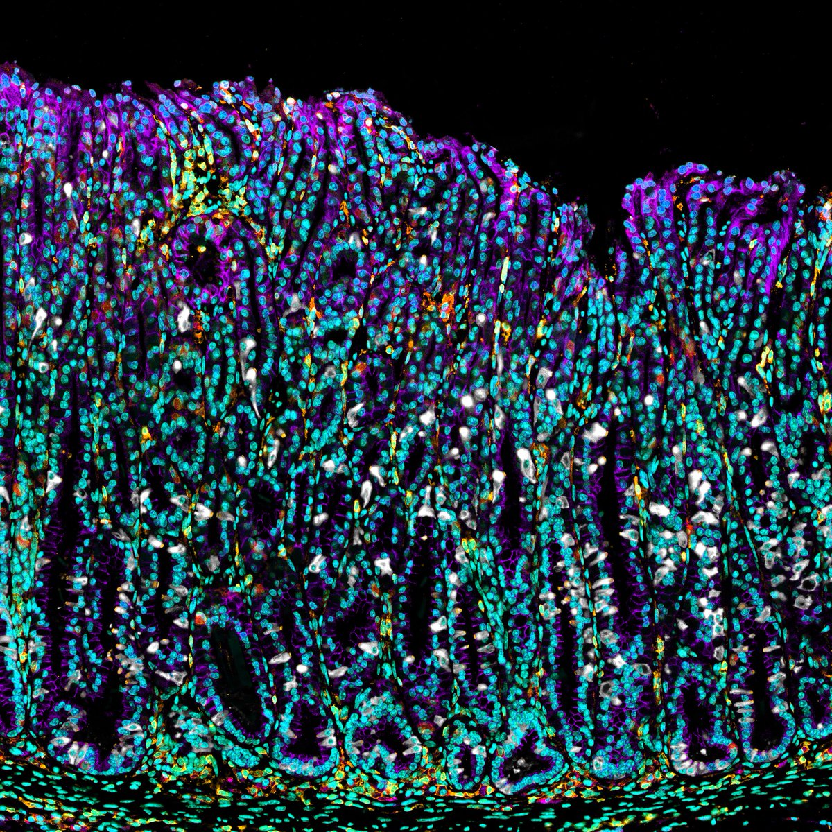 AmyEngevik's tweet photo. Tuft cells in white for #TuftTuesday https://t.co/Uu8GSNFz58