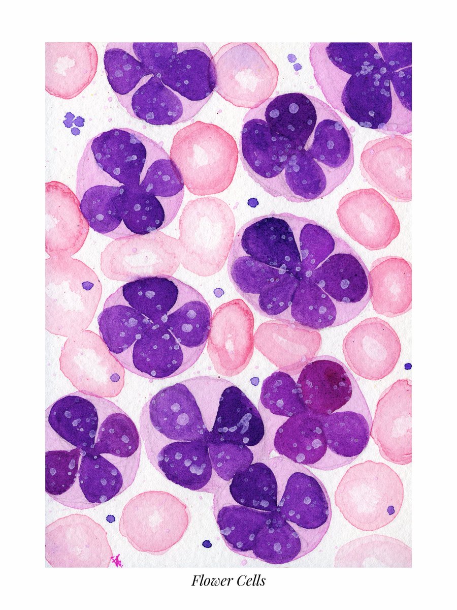 path_girl88's tweet photo. Flower Cells and Reed-Sternberg Cells as part my Spooky Cell October where I paint cells with certain characteristics (costumes π) which can give a clue to the diagnosis. Done in watercolor π. #pathology #spookycelloctober #pathx #pathart https://t.co/Rd32hcgY7n
