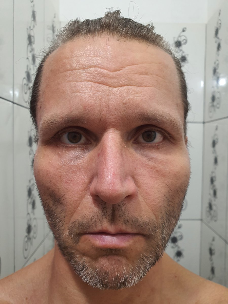 SalomonRejuven's tweet photo. ๐ฅ I found the fountain of youth of the emperors.
Day 4669 Age 54 โ reversing into low 40s.
No filters. No shortcuts. Just biology reactivated.
Goal: 25.
I post daily until I get there. Watch closely.
๐ช
#RejuvenationBodybuilding #ReverseAging #Longevity #Shredded https://t.co/IQiClYkrS5