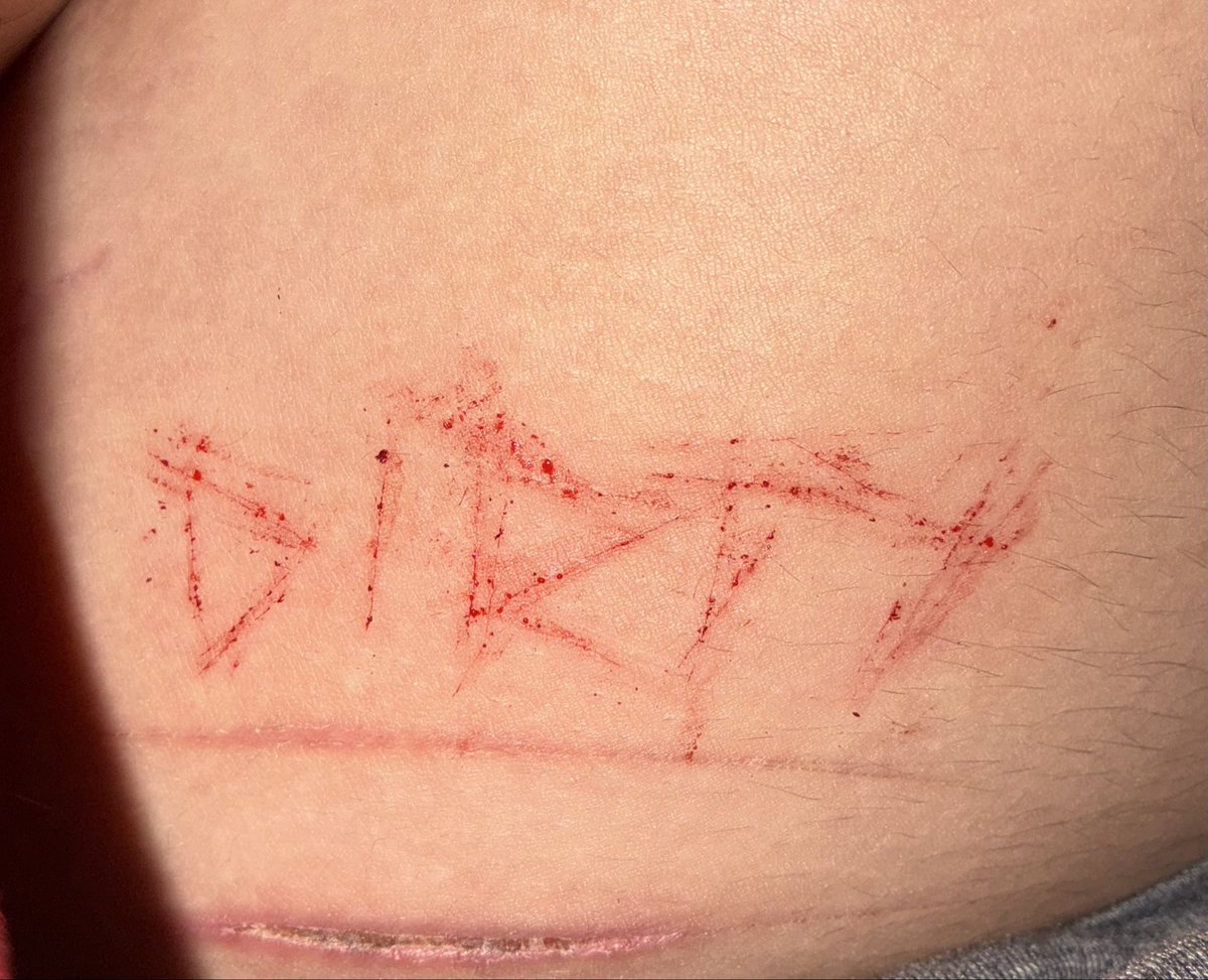 gummyshh's tweet photo. what i deserve. too much of a pussy to go deeper. fake ofc https://t.co/33YAHb46Yd