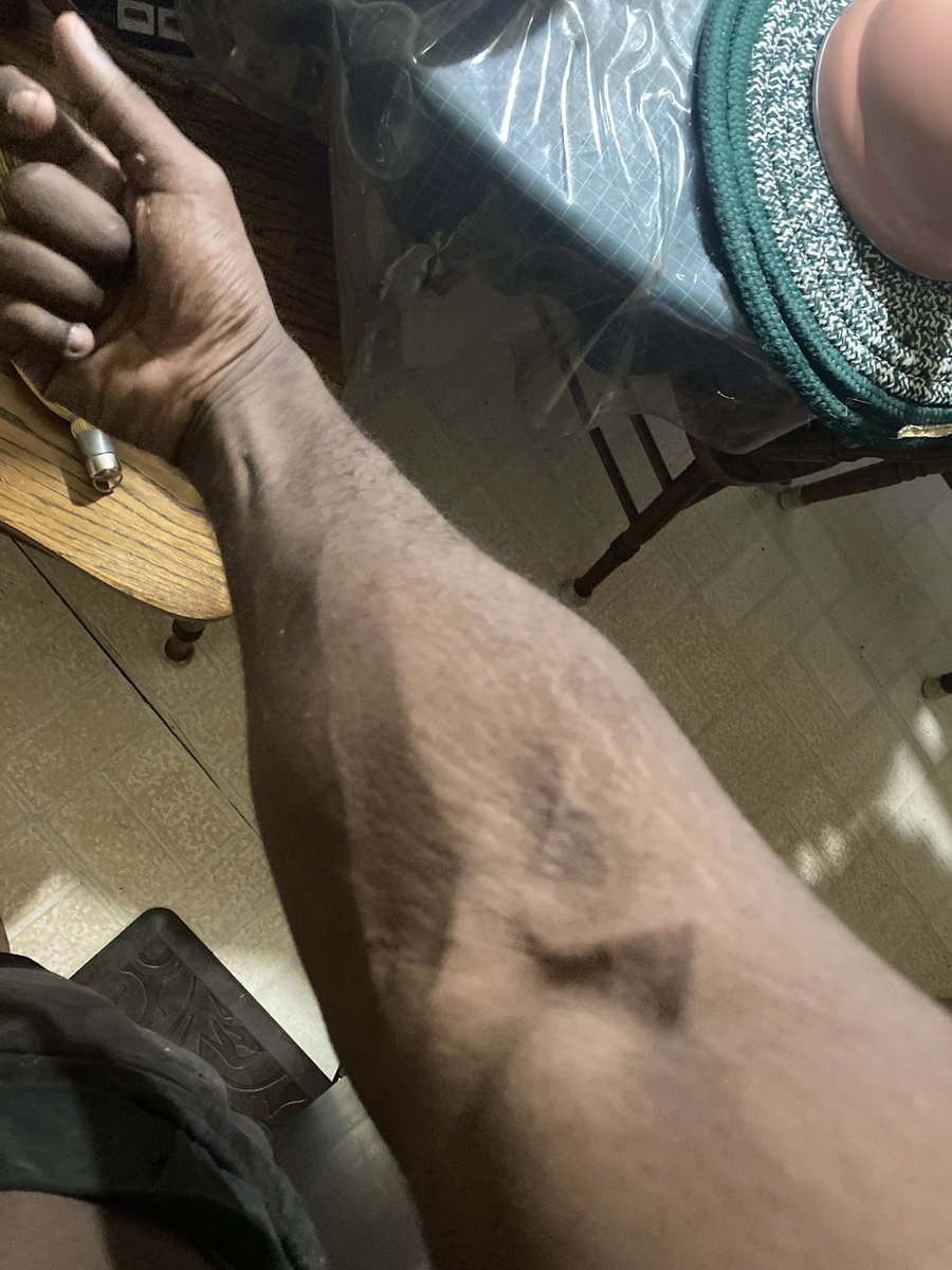SSKSpeedy's tweet photo. Veins 🩸 https://t.co/ifObfv9x5l