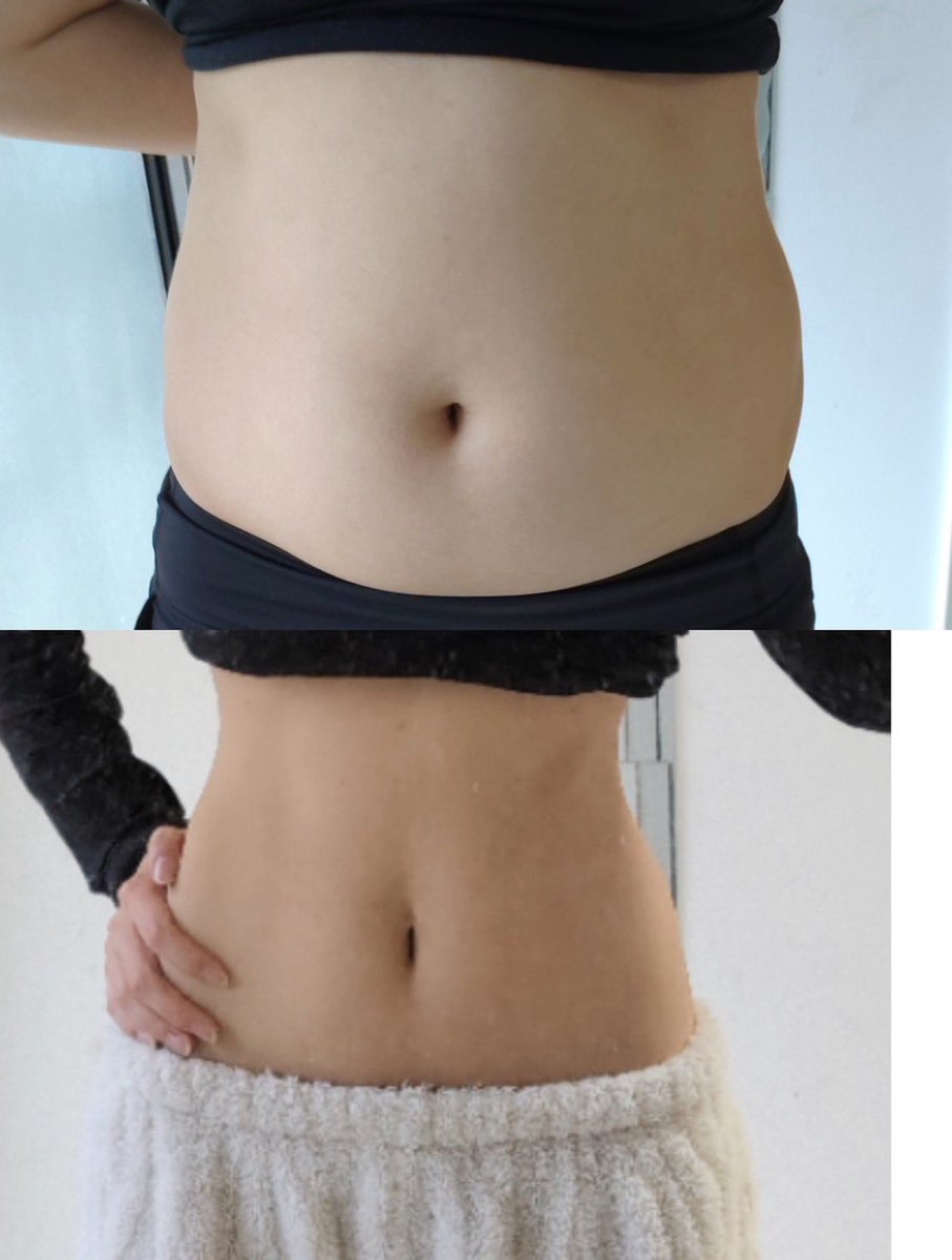 me_zase_10kg's tweet photo. まてまて！2週間でこの変化はやばくないか？しかも1分だけなのにお腹のﾌﾞﾖﾌﾞﾖ肉全部消えたんだが…😭 https://t.co/CKncFWHwow
