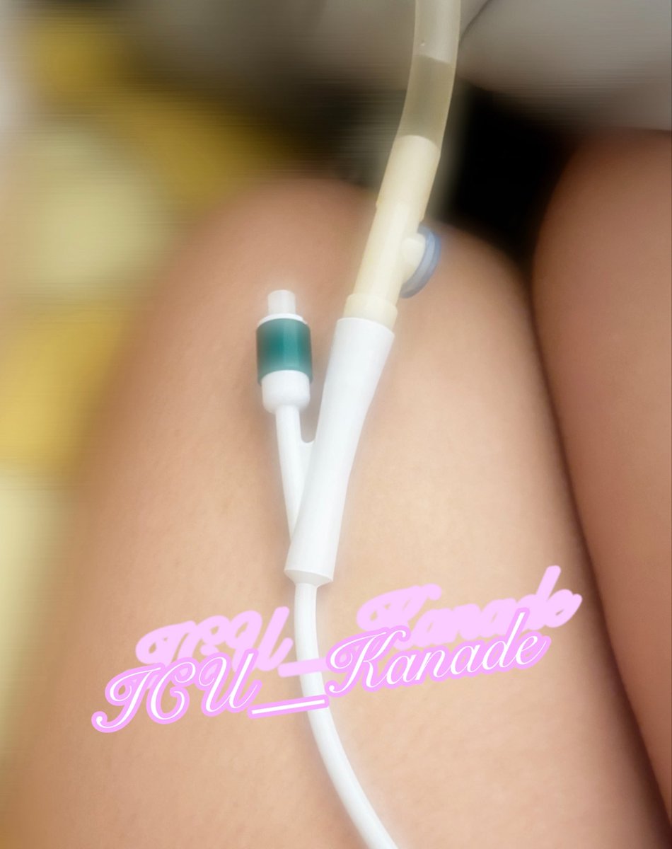 ICU__Kanade's tweet photo. 昨日から
プレイじゃなくて､病院で入れて貰って
暫くは続きそう。
来月も交換に行きます。 https://t.co/8r5CCXDRIk