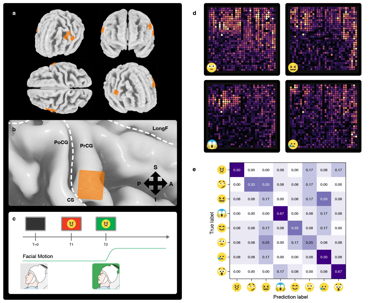 Precision Neuroscience on X: 