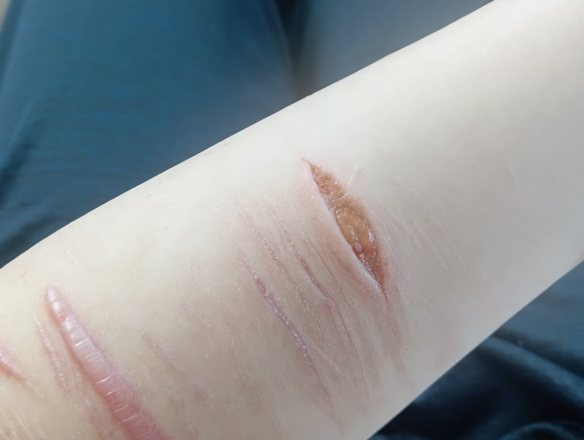 gomikasu_zzz's tweet photo. #sh   #selfharm
Halloween makeup fake
←2日前　　　　　現在→ https://t.co/slB2LkB0Fs
