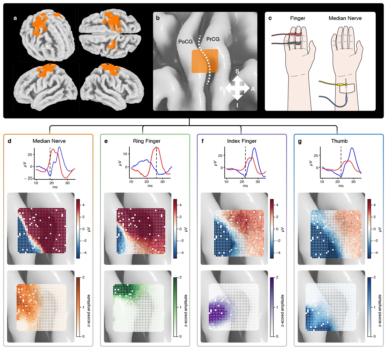 Precision Neuroscience on X: 