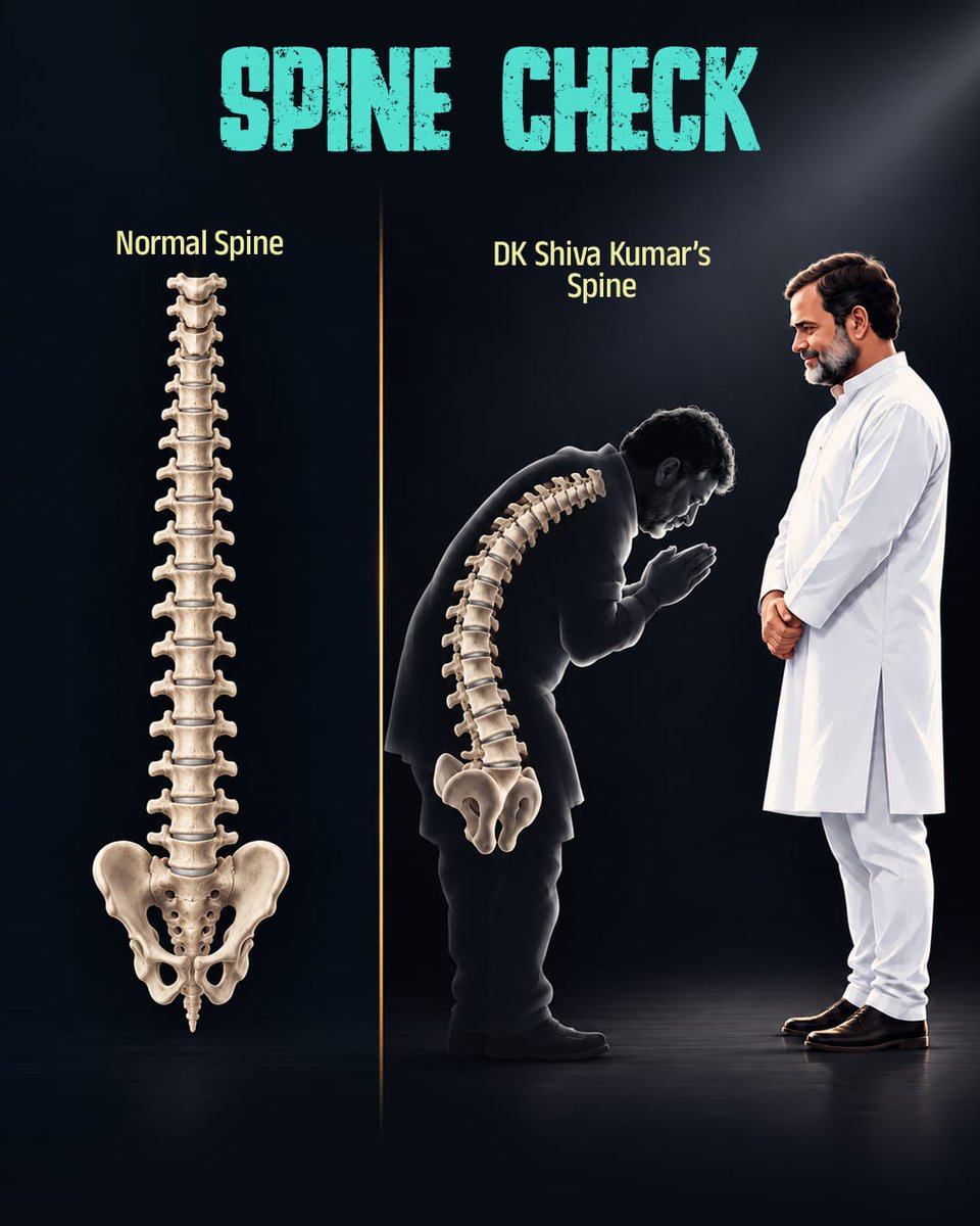 BJP4Karnataka's tweet photo. Normal Spine: |
DKS Spine before High Command: / https://t.co/pDrABySCgW